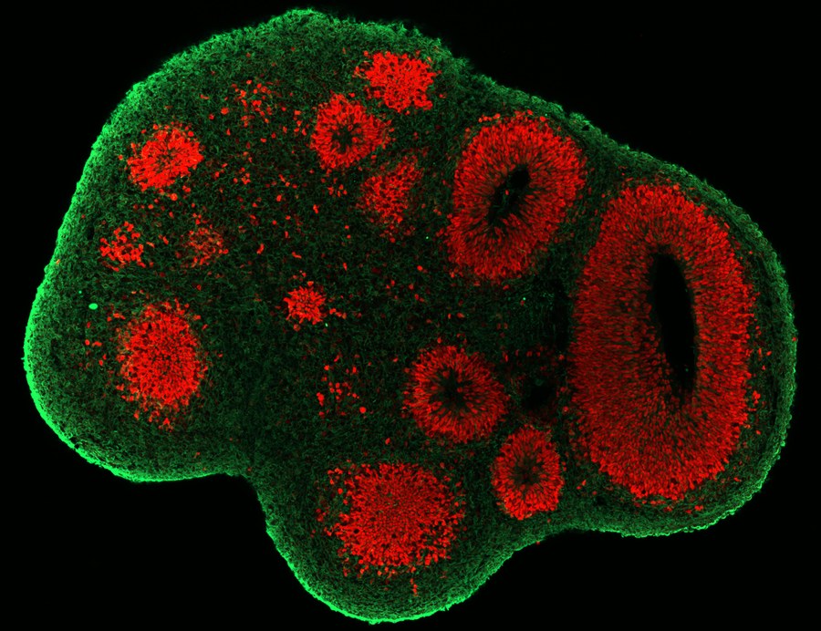 Brain organoids – science-fiction in real life